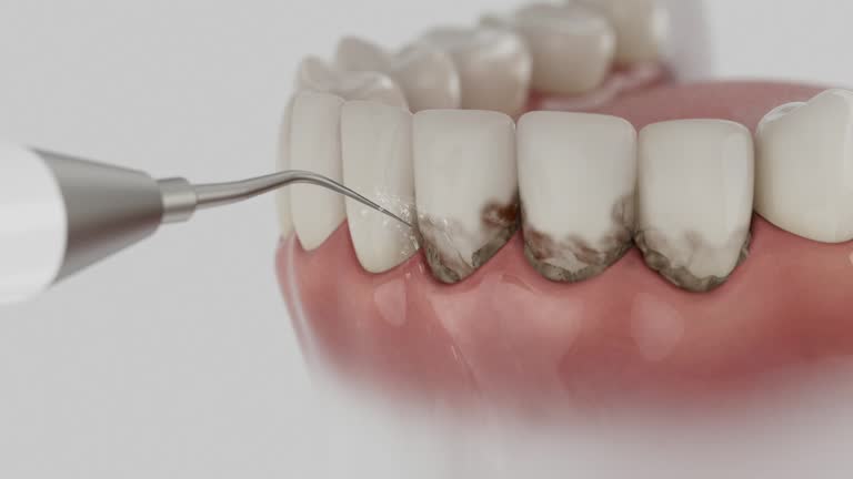 Reliable Dental contractor in Saginaw, TX by Smile Center Dentistry